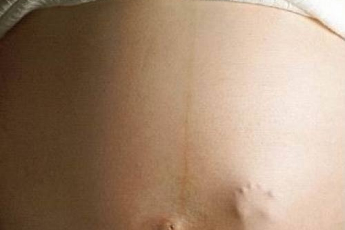 во время беременности появились пятна на груди фото 54