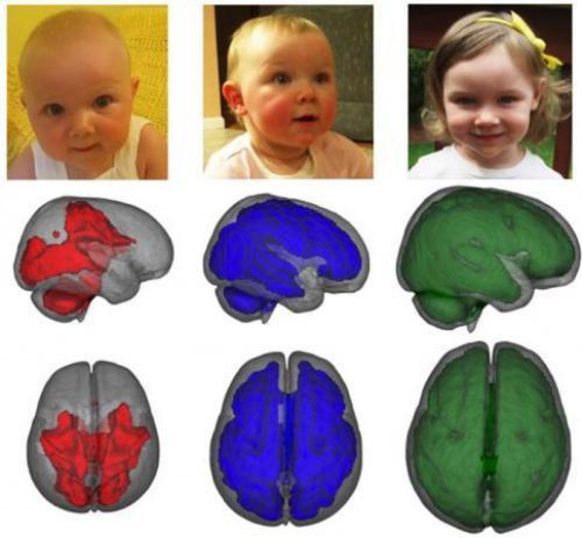 Ο εγκέφαλος των μωρών που θηλάζουν παρουσιάζει πρώιμη ανάπτυξη