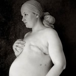 Η Stephanie, έγκυος στο 4ο παιδάκι της, με το σημάδι από τη μαστεκτομή.