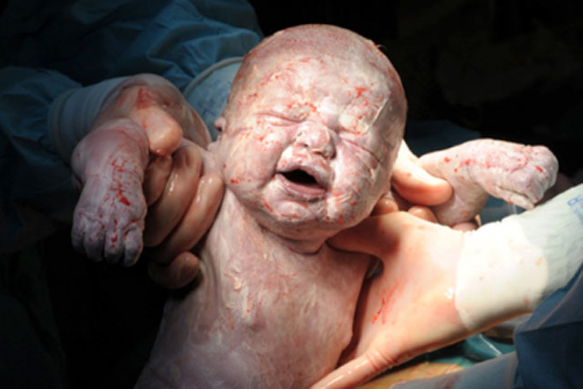 Η πρώτη ανάσα: Το θαύμα της γέννησης σε φωτογραφίες