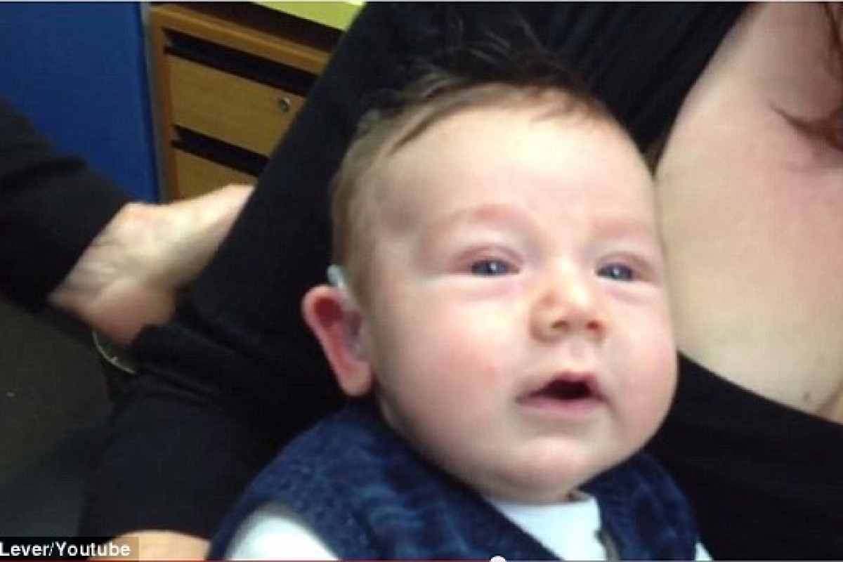 [Βίντεο] Μωράκι 7 εβδομάδων ακούει για πρώτη φορά