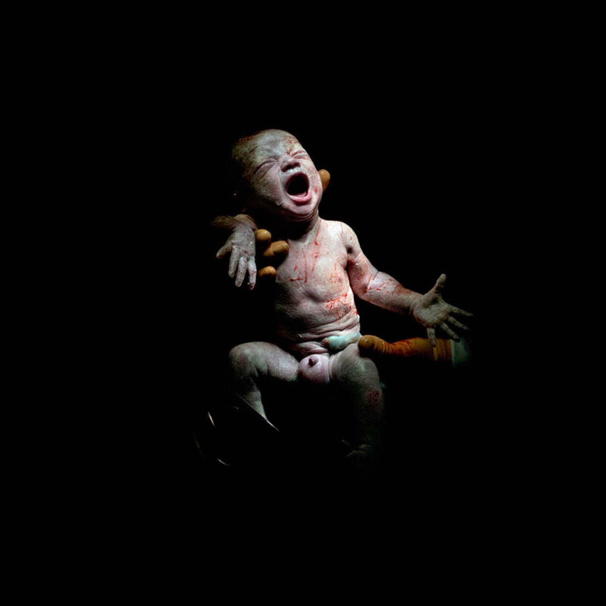 Τα πρώτα δευτερόλεπτα της ζωής τους: Φωτογραφίες νεογέννητων τη στιγμή που έρχονται στον κόσμο μας