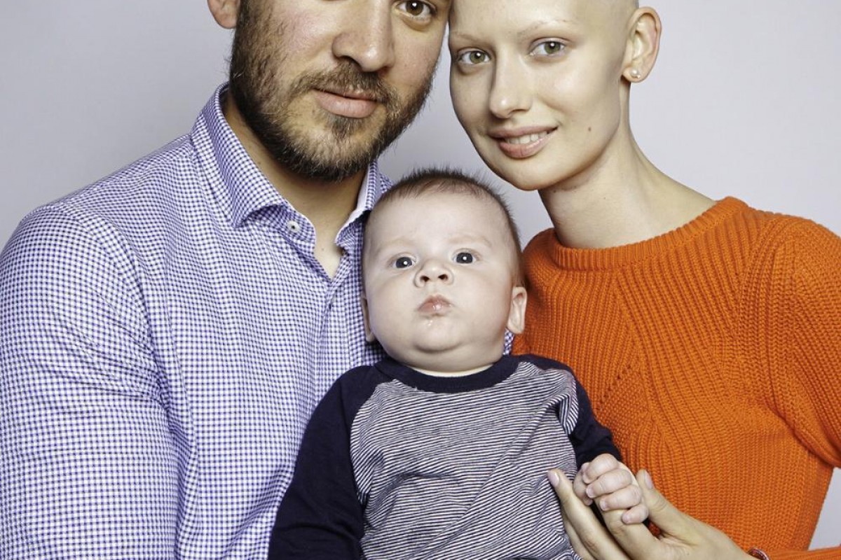 Το μοντέλο που έχασε το σαγόνι της από τον καρκίνο αλλά κράτησε το παιδί της και συνέχισε να πολεμά για την οικογένειά της
