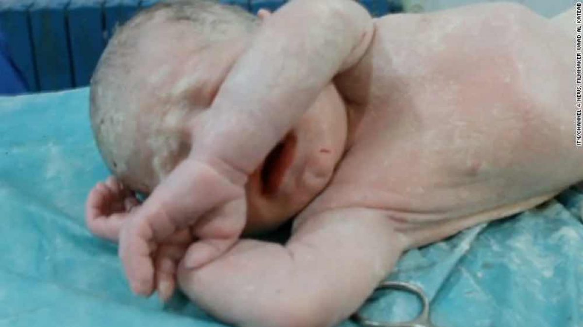 Το μωρό που διάλεξε να ζήσει! | Ένα συγκλονιστικό βίντεο