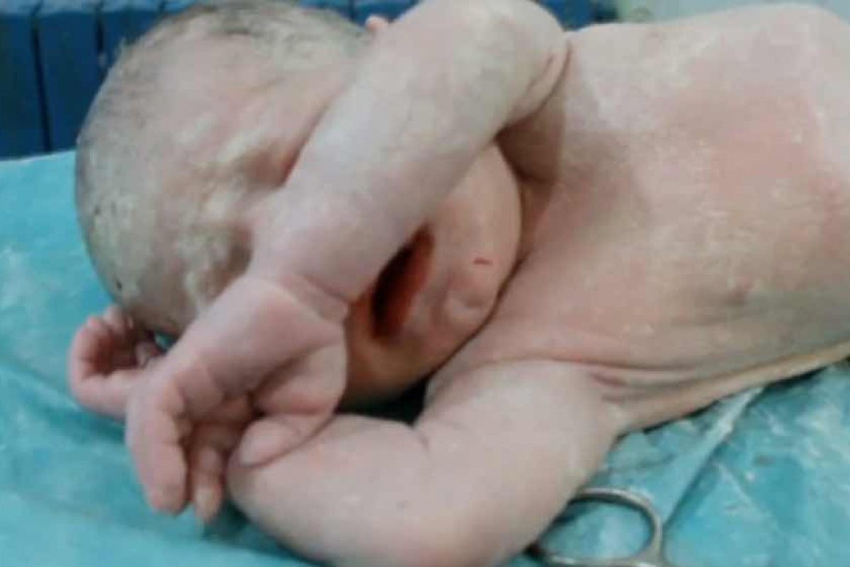 Το μωρό που διάλεξε να ζήσει! | Ένα συγκλονιστικό βίντεο
