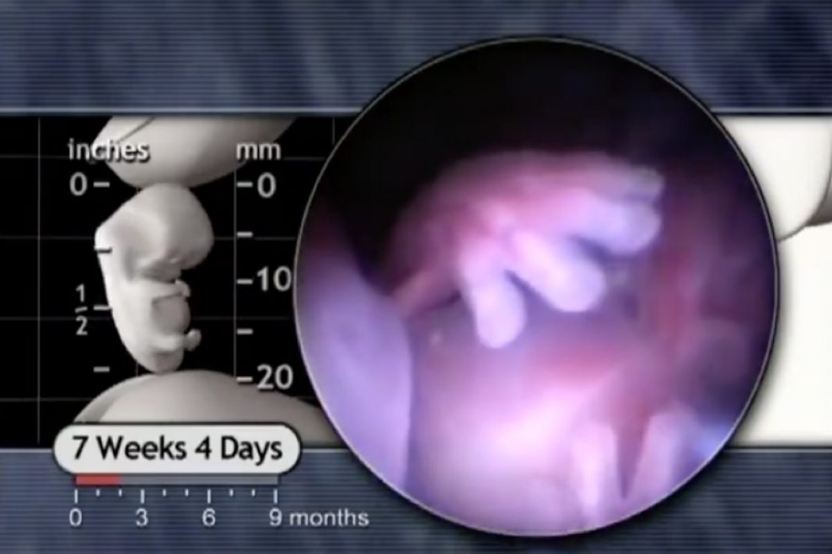 Απίστευτο βίντεο: να πώς μοιάζει ένα μωρό την 8η εβδομάδα εγκυμοσύνης!