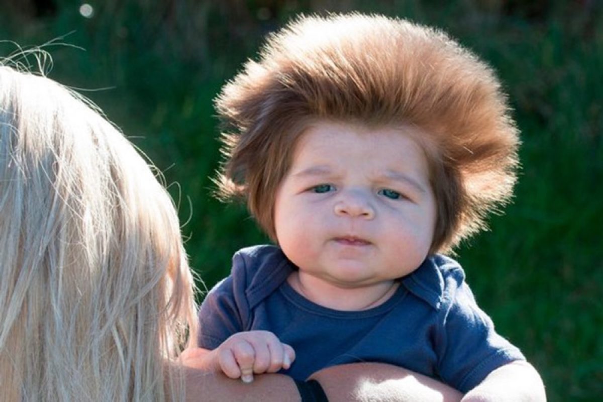 Γνωρίστε το μωράκι με το πιο τρελό μαλλί!