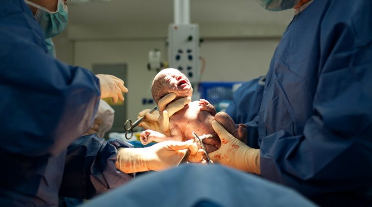 Έρευνα-σοκ: Πάνω από τις μισές Ελληνίδες γεννούν με καισαρική