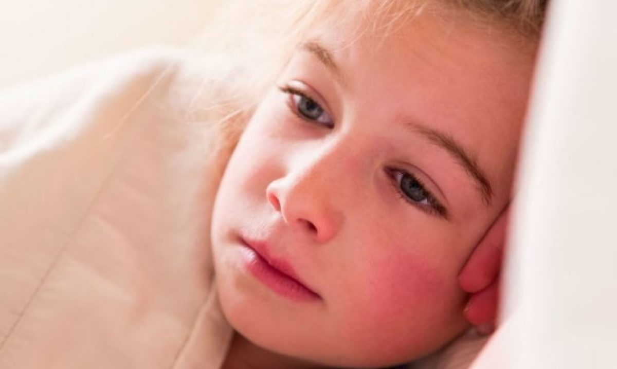 Παιδικές ασθένειες: Τι πρέπει να ξέρετε για την “πέμπτη νόσο” (παρβοϊός)