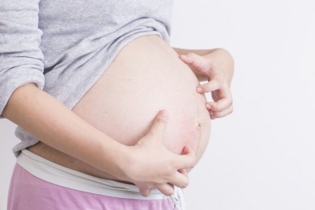 Η φαγούρα στην εγκυμοσύνη και η σωστή αντιμετώπιση