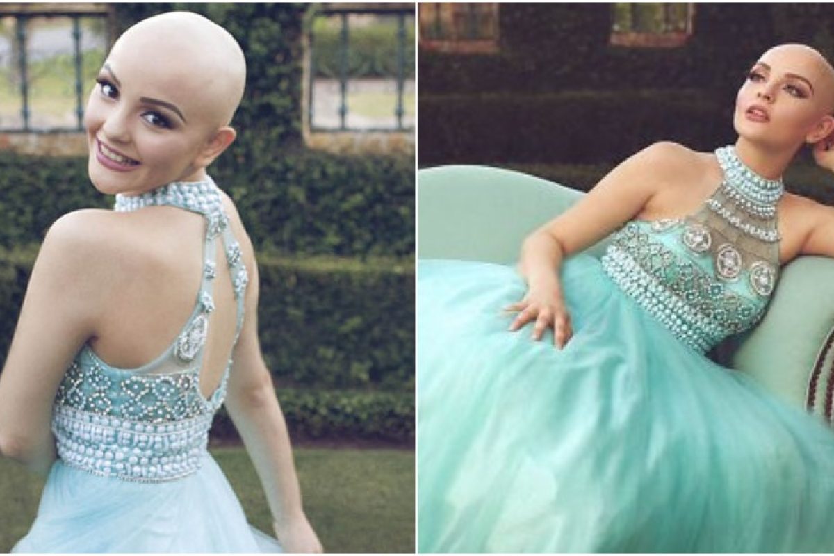Υποκλινόμαστε…. 17χρονη καρκινοπαθής πρότυπο: «Ο καρκίνος δεν με εμποδίζει να είμαι πριγκίπισσα»