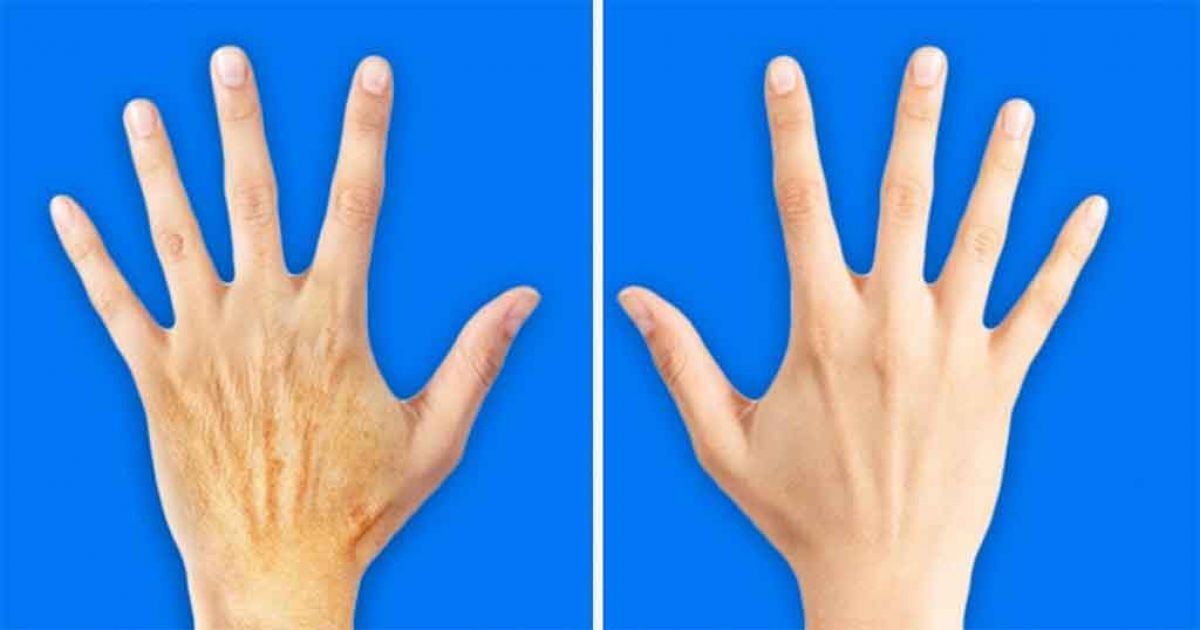 5 μυστικά για να κάνετε τα χέρια σας 10 χρόνια νεότερα