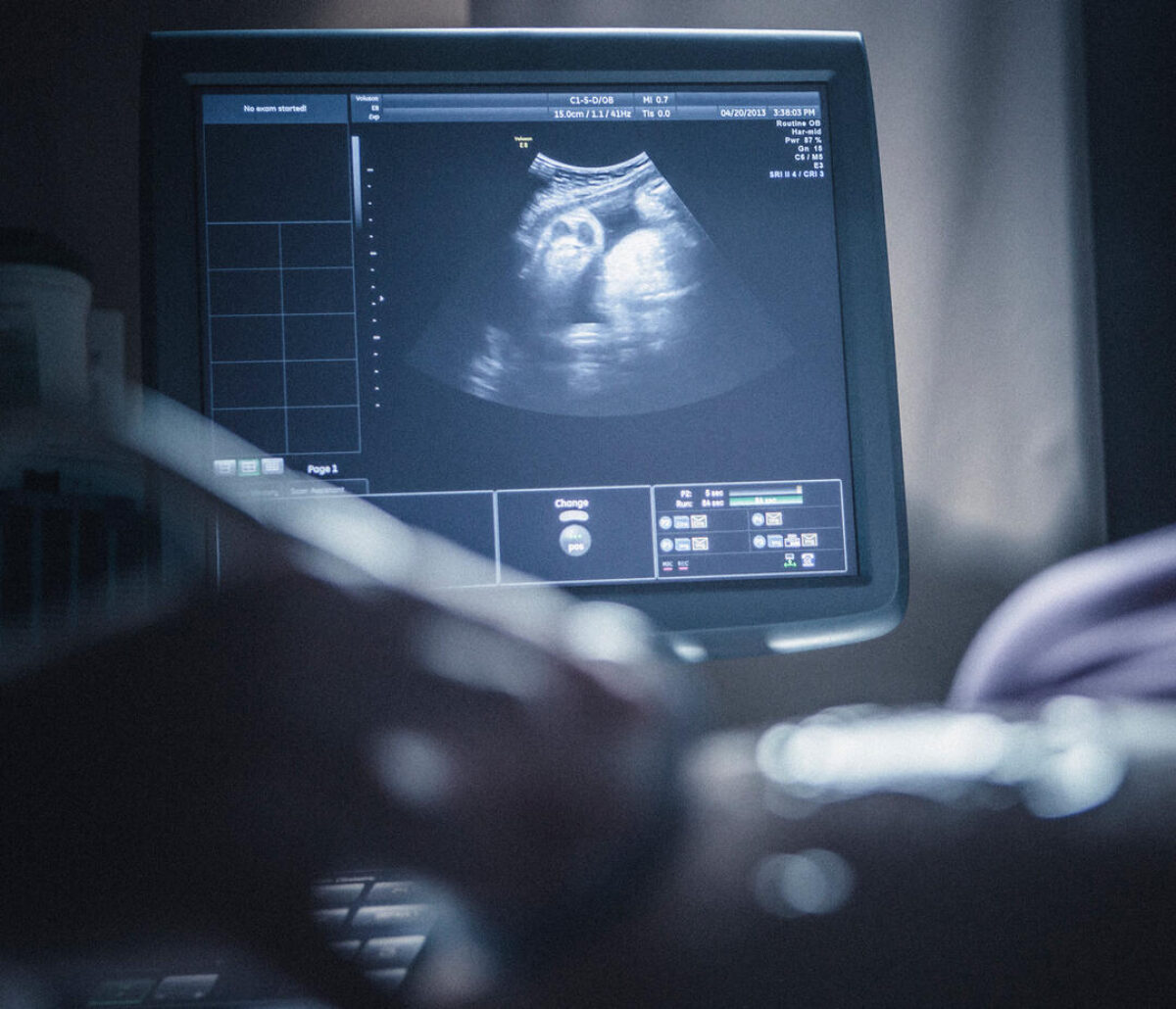Αυχενική Διαφάνεια: Η πιο πολύτιμη εξέταση της εγκυμοσύνης